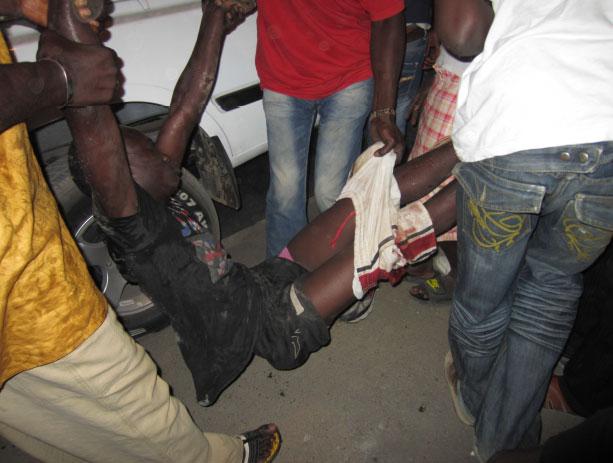 VOL À MAIN ARMÉE MANQUÉ A BENE BARAQUE: Un agresseur se fait fracasser la tête avec sa machette