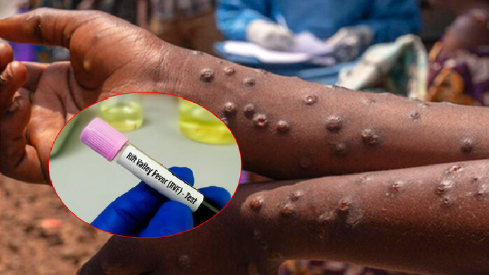 Fièvre de la vallée du Rift : aucun décès