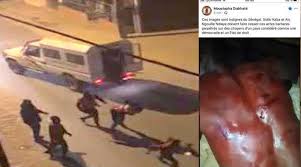 VIOLENCES POLICIERES POUR FAIRE RESPECTER LE COUVRE-FEU : Les organisations de défense des droits de l’homme disent non et invitent Aly Ngouille Ndiaye à parler à ses hommes