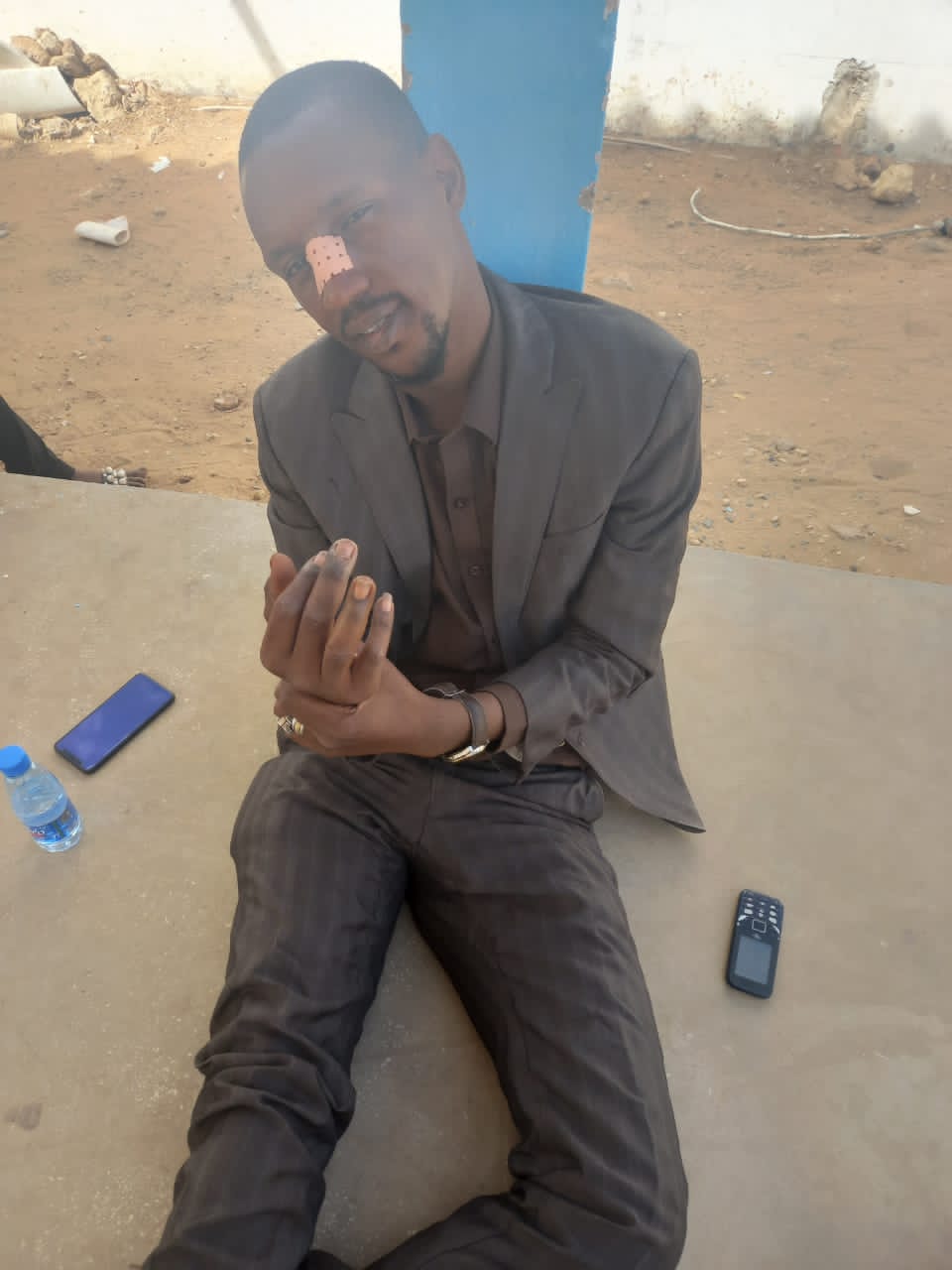 Pape Ndiaye responsable departemental  jëf jël:Nez et doigt cassés, mandataire WA THIES de Talla Sylla aux urgences