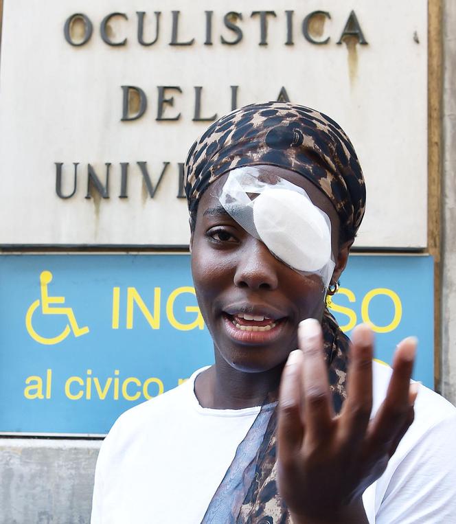 ATTAQUE RACISTE CONTRE UN SENEGALAIS EN ITALIE :Le compatriote perd son œil droit