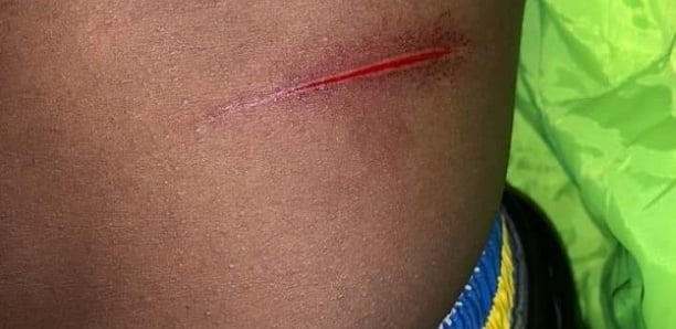 Le président du Mouvement des élèves et étudiants pour le développement de Ziguinchor tabassé