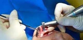 EXERCICE ILLÉGAL À GUÉDIAWAYE : Un faux dentiste met en danger la vie d’un patient