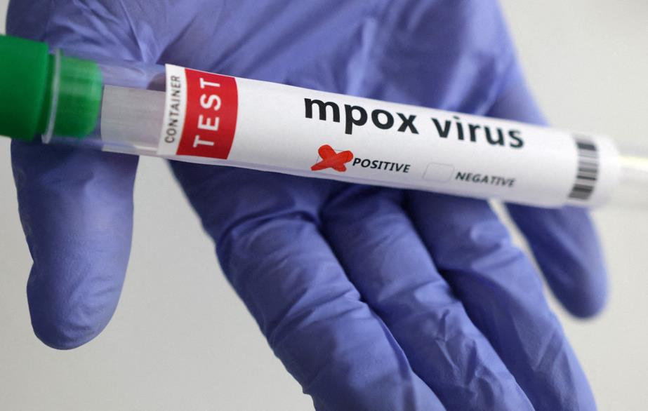 Premier cas de Mpox détecté à Dakar