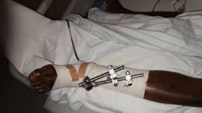 OPÉRATION À GOUYE FATOU MAIGA : Un dealer se casse une jambe en sautant d'une terrasse pour échapper aux policiers