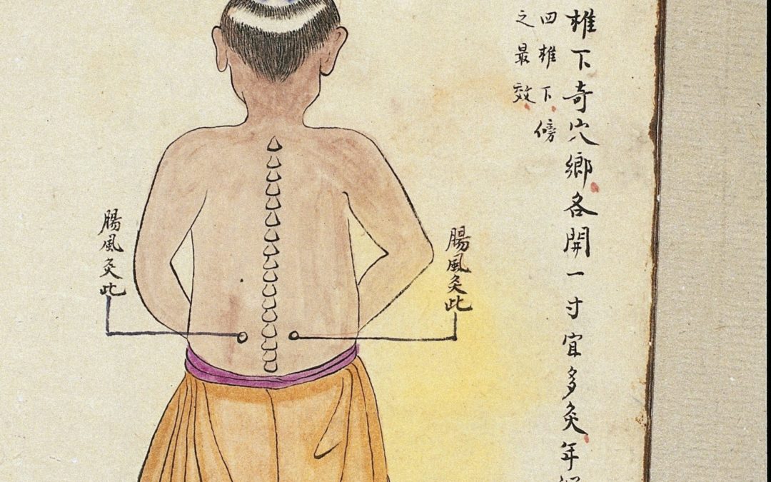 L’ACUPUNCTURE, LES VENTOUSES, LA MOXIBUSTION, LE MASSAGE THÉRAPEUTIQUE ET LE BADUANJIN : La médecine traditionnelle chinoise s’invite au plateau médical