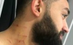 VIDEO : Un joueur turc attaque ses adversaires à coups de lame de rasoir
