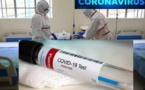 En direct:Nombre de personnes décédées à cause du coronavirus COVID-19 dans le monde selon le pays 
