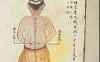 L’ACUPUNCTURE, LES VENTOUSES, LA MOXIBUSTION, LE MASSAGE THÉRAPEUTIQUE ET LE BADUANJIN : La médecine traditionnelle chinoise s’invite au plateau médical