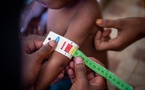 Pikine : 13,7 % des enfants de moins de 5 ans souffrent d'une malnutrition aiguë globale (Mag)