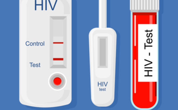 13 parmi ces derniers testés positifs au Vih-sida